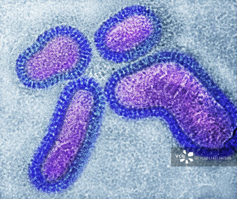 流感病毒颗粒（透射电镜）图片素材