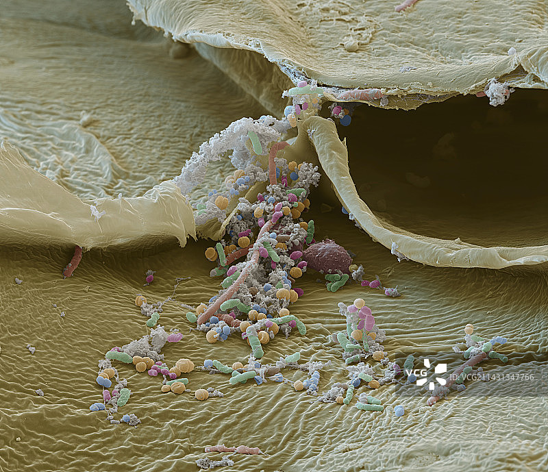 发酵卷心菜上的细菌（扫描电镜图）图片素材