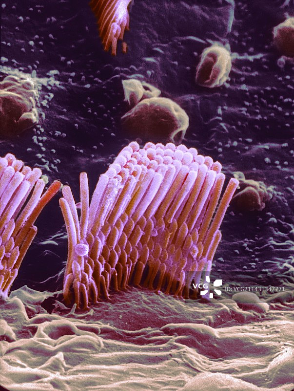 人耳毛细胞扫描电镜图图片素材