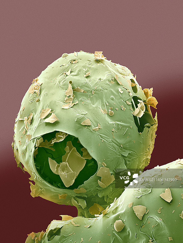 阿斯巴甜甜味剂晶体，扫描电镜图片素材