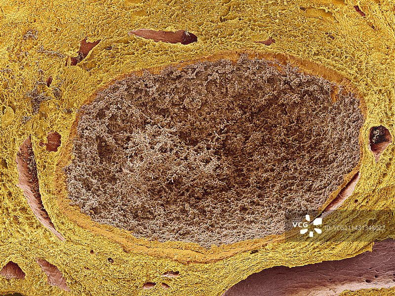 黄体扫描电镜图片素材