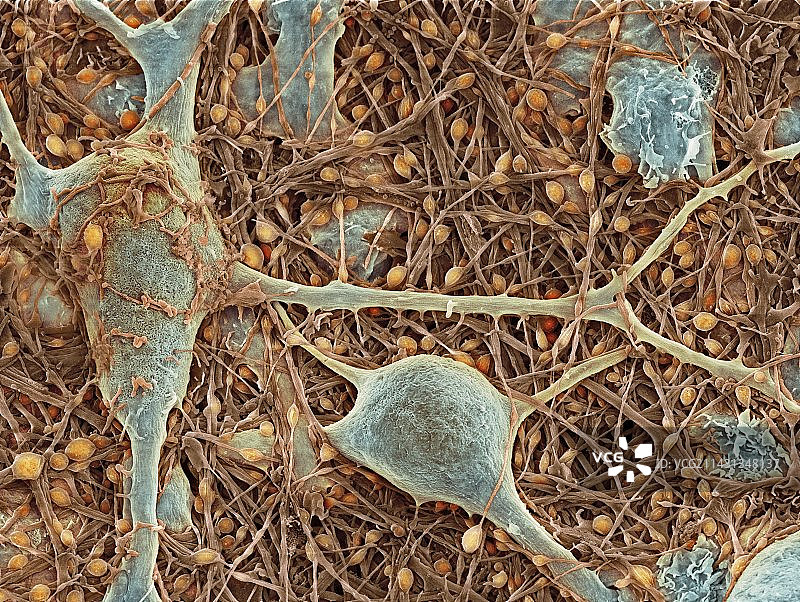 神经细胞和神经胶质细胞，扫描电子显微镜图片素材