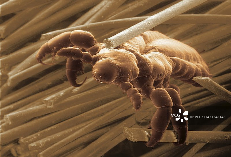 头虱,扫描电子显微镜图片素材