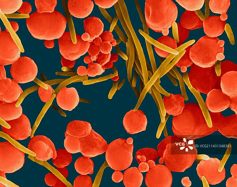 犬噬二氧化碳嗜纤维菌DF-2，细菌，扫描电镜图片素材