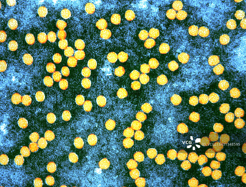 口蹄疫病毒的彩色透射电镜图像图片素材