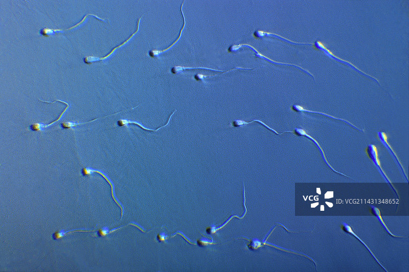 人类精子图片素材