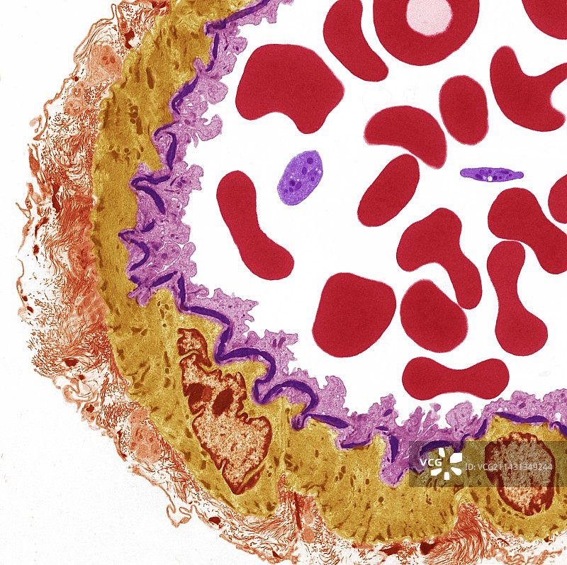 动脉，TEM图片素材