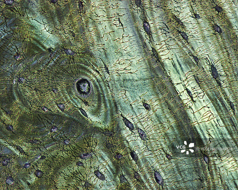 骨骼结构显微照片图片素材