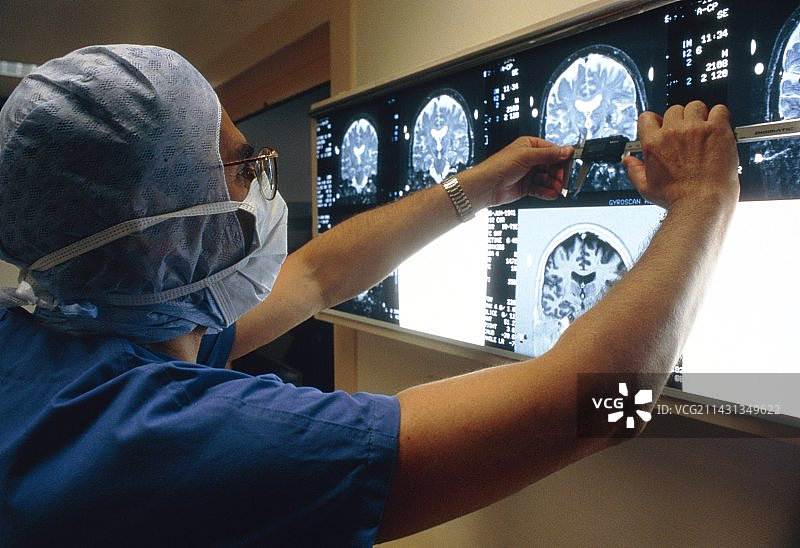 外科医生与MRI扫描：用于机器人脑外科手术图片素材