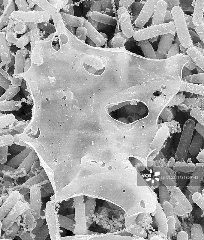 吸水链霉菌扫描电子显微镜图图片素材
