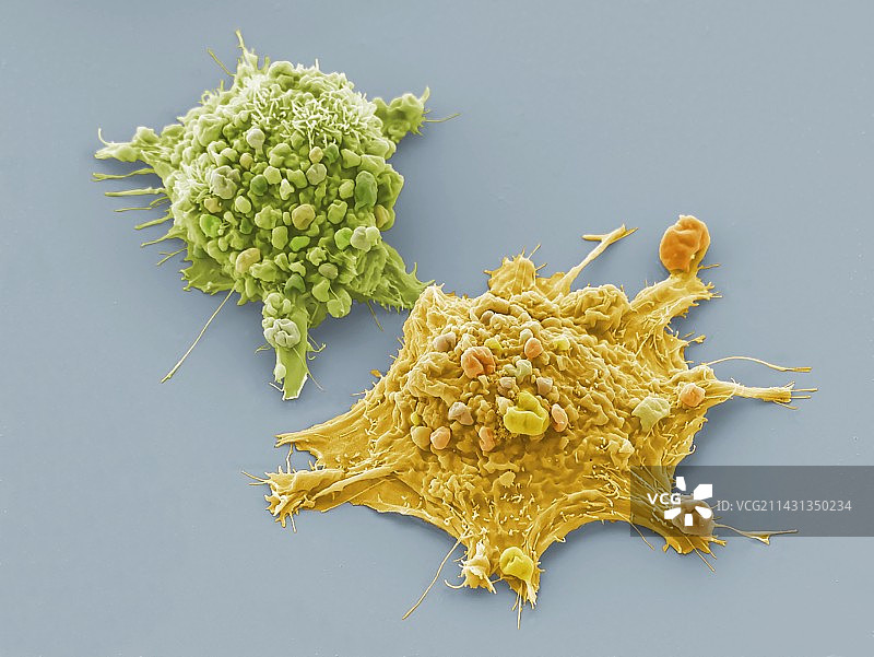 肺癌细胞扫描电镜图图片素材