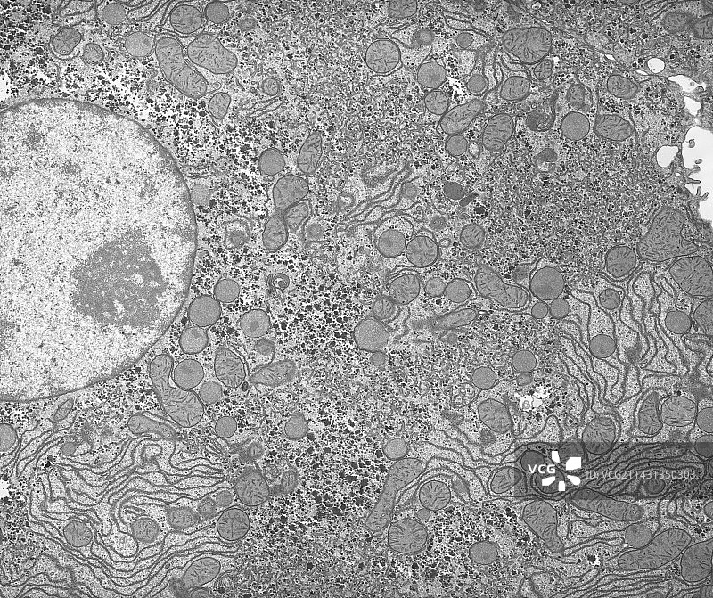 肝脏，TEM图片素材