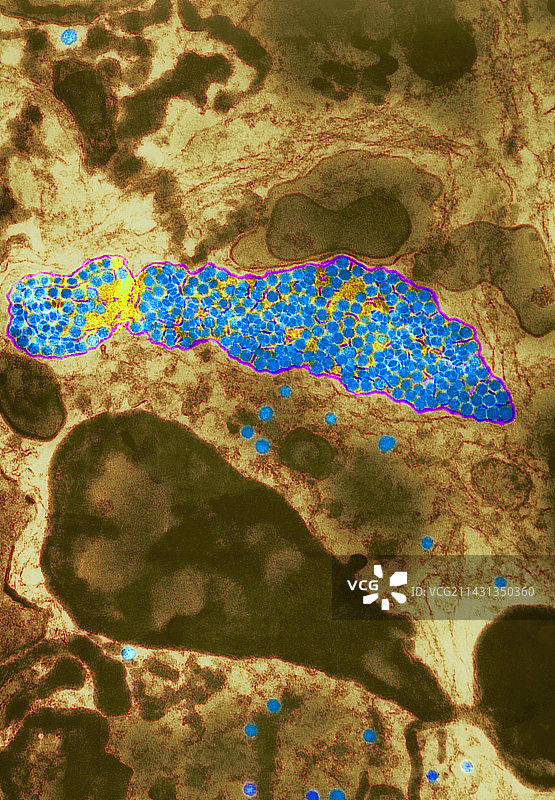 登革热病毒颗粒,透射电镜图片素材