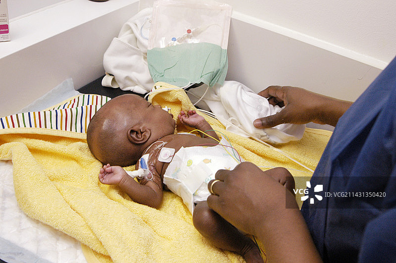 早产儿图片素材