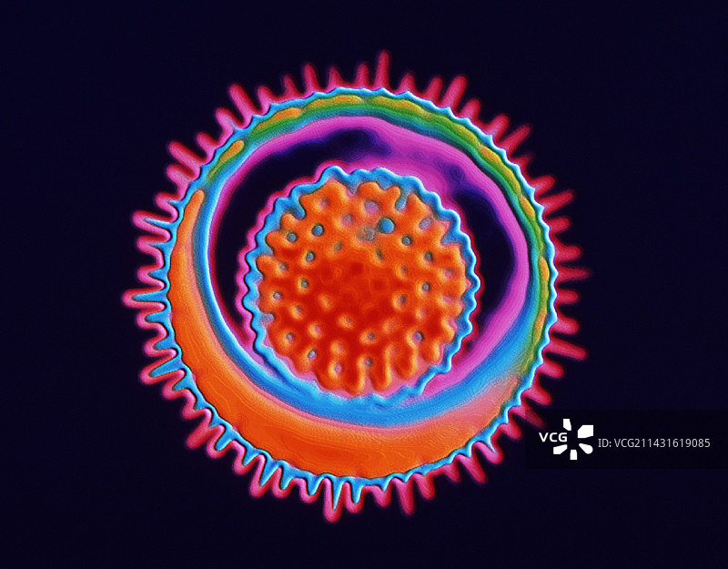 单纯疱疹病毒图片素材