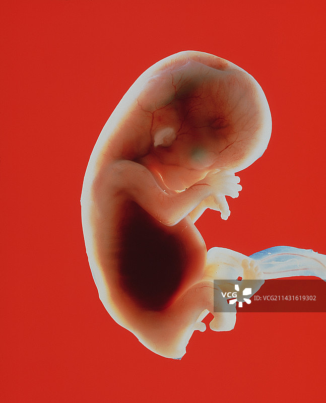11周的胎儿图片素材