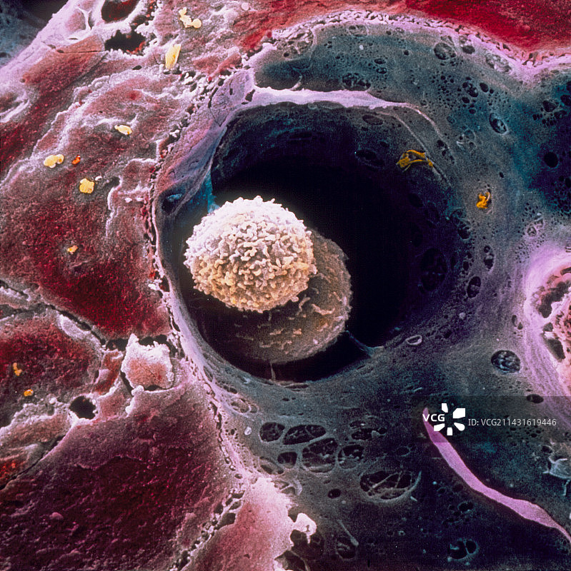 肝脏内白细胞的伪彩色扫描电子显微镜图像图片素材