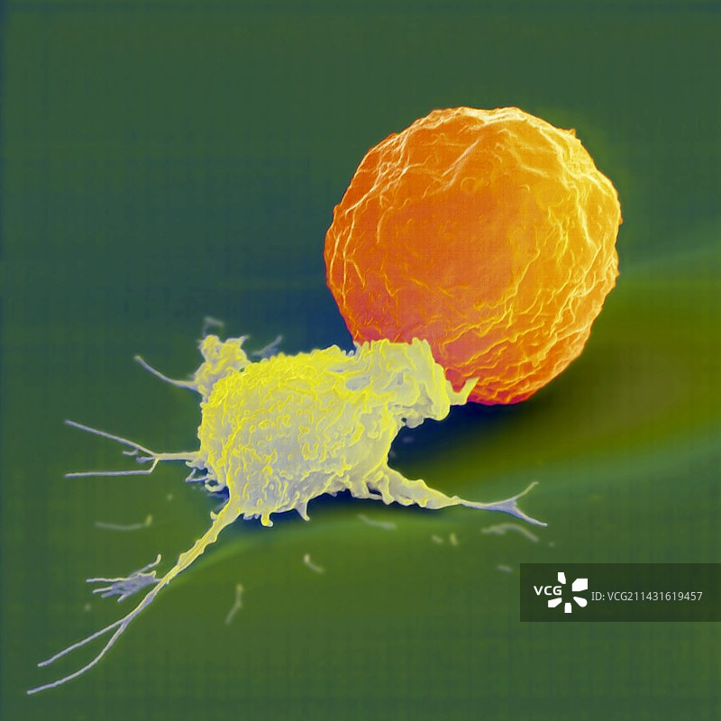 杀伤细胞攻击癌细胞的彩色扫描电镜图图片素材