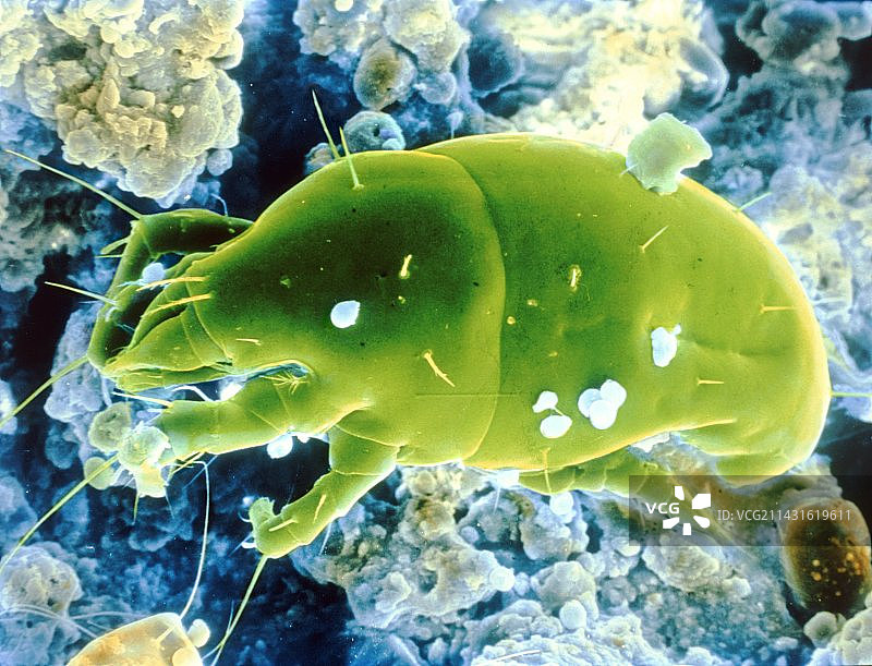 未识别尘螨的伪彩色扫描电镜图图片素材