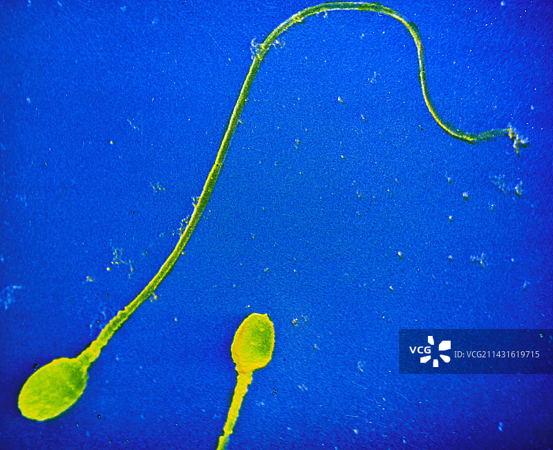 人类精子的透射电子显微镜照片图片素材