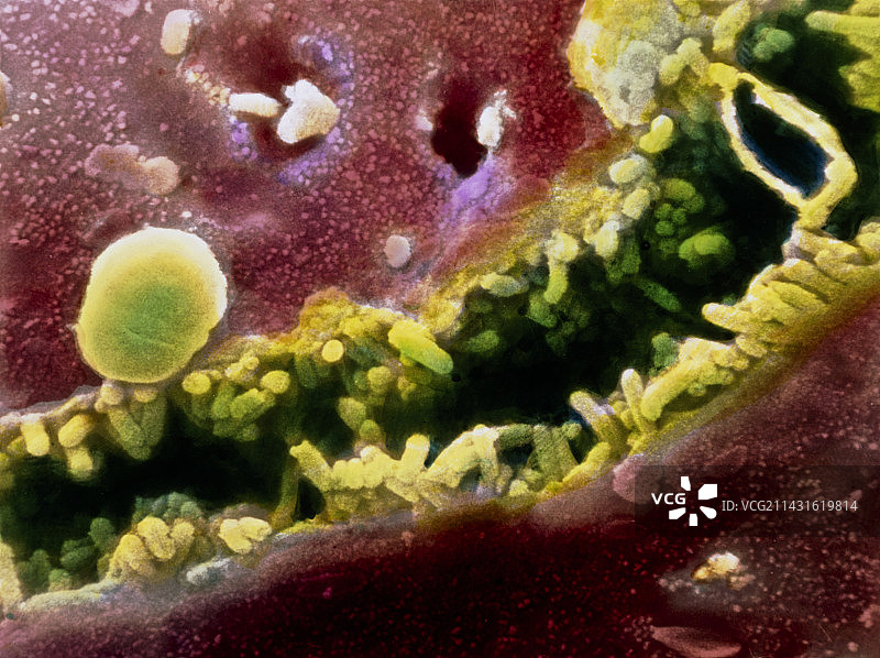 肝脏内胆小管的彩色扫描电镜图图片素材