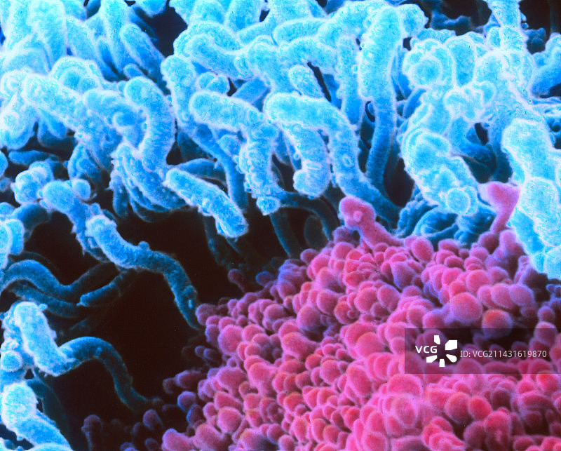 十二指肠中的密螺旋体细菌图片素材