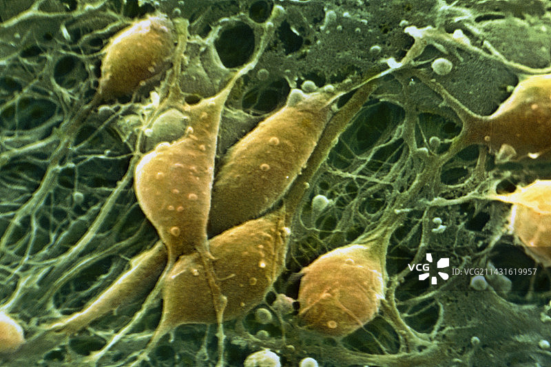 大脑神经元的伪彩色扫描电镜图图片素材