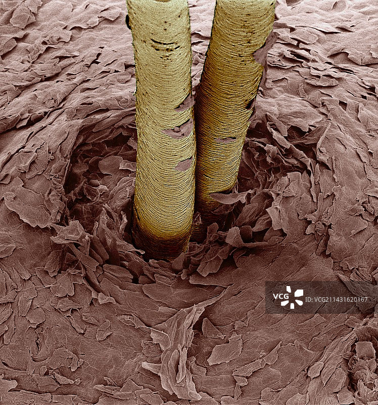 皮肤中人类毛发的彩色扫描电镜图图片素材
