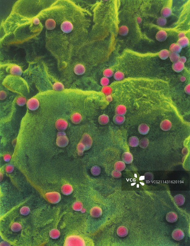 感染艾滋病毒的T细胞的扫描电子显微镜照片图片素材