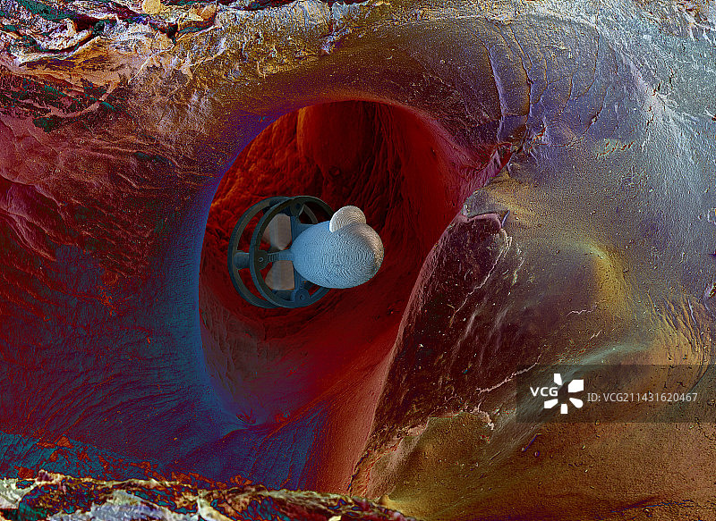 动脉中的微型潜艇图片素材