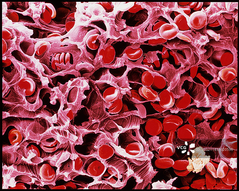 彩色扫描电镜下的受伤血凝块图片素材
