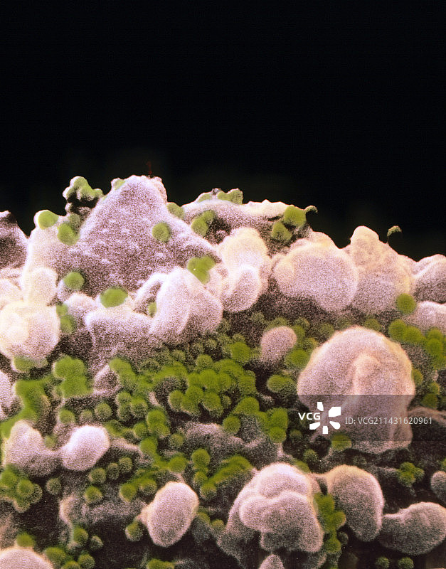 感染艾滋病毒的T淋巴细胞的扫描电子显微镜图像图片素材