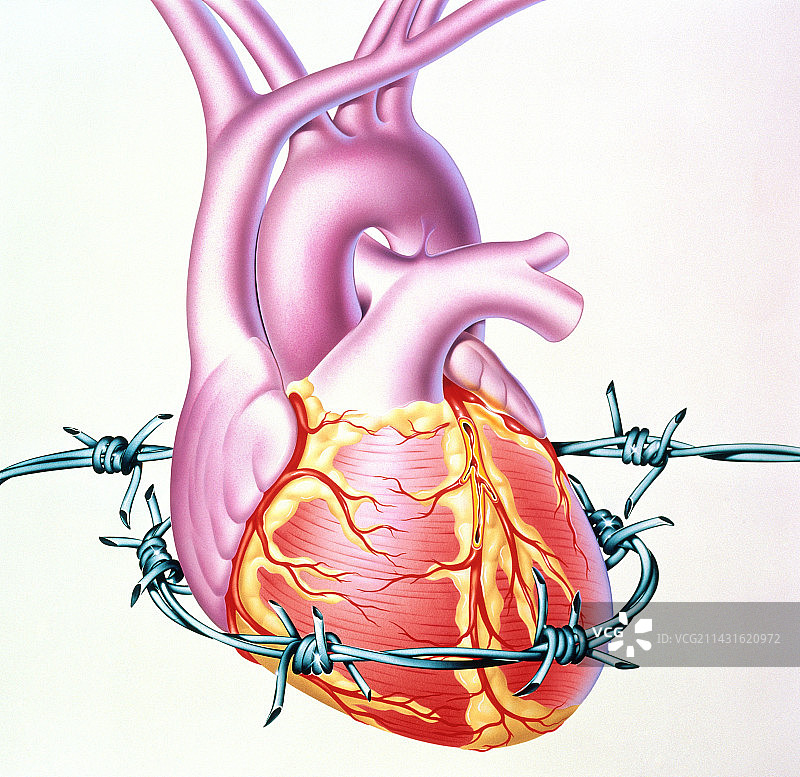 心脏疾病图片素材