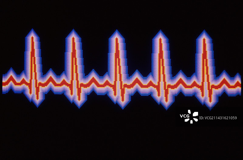 心跳轨迹图片素材