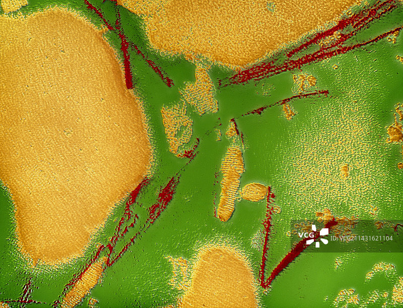羊瘙痒病相关原纤维的伪彩TEM图像图片素材