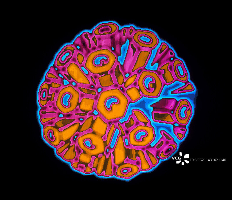 普通感冒病毒图片素材