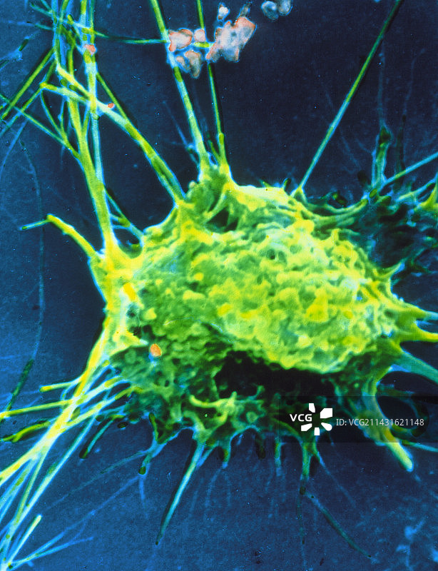 活跃巨噬细胞的伪彩色扫描电镜图像图片素材