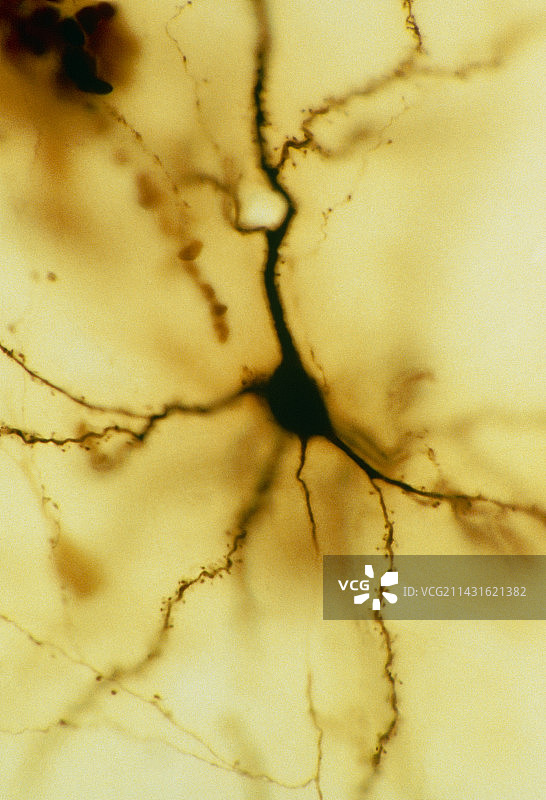 锥体神经元的光学显微照片图片素材
