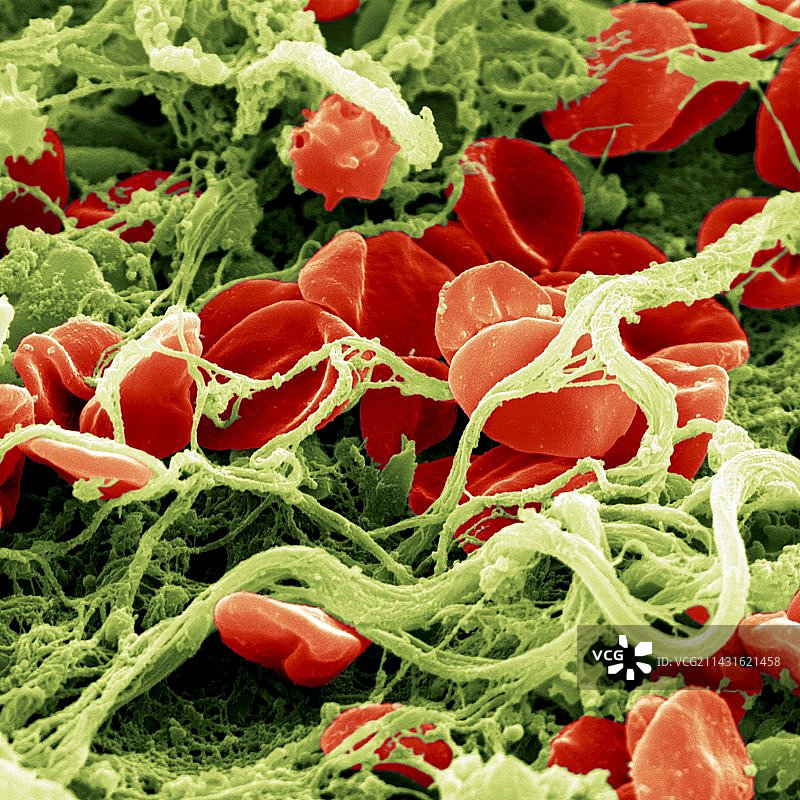 血凝块图片素材