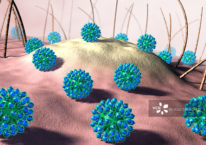 人类乳头瘤病毒颗粒，艺术作品图片素材