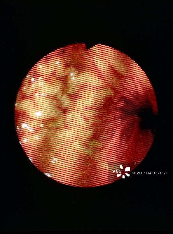 胃内壁图片素材
