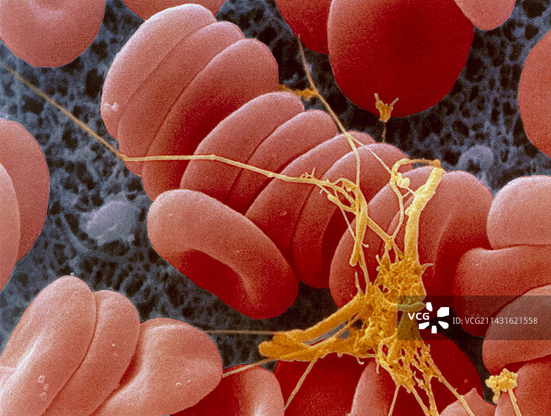 早期血栓形成的扫描电镜彩色图像图片素材