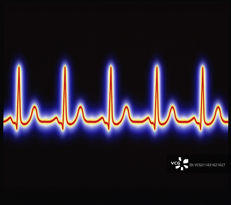 健康心跳的计算机图图片素材