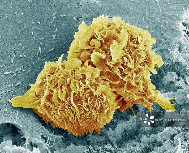 骨癌细胞扫描电镜图图片素材