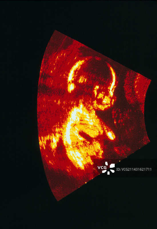 21周人类胎儿的超声波扫描图片素材