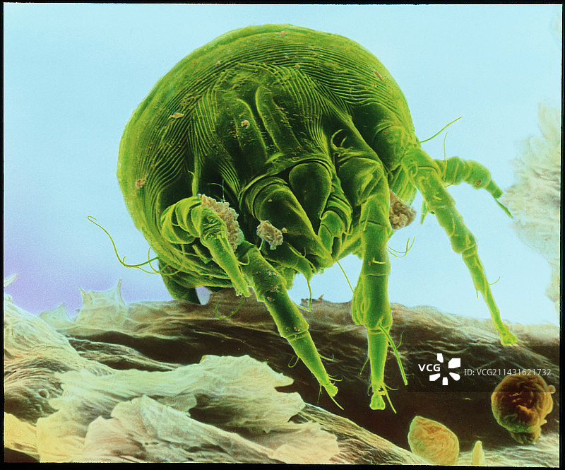 彩色尘螨电镜照片图片素材