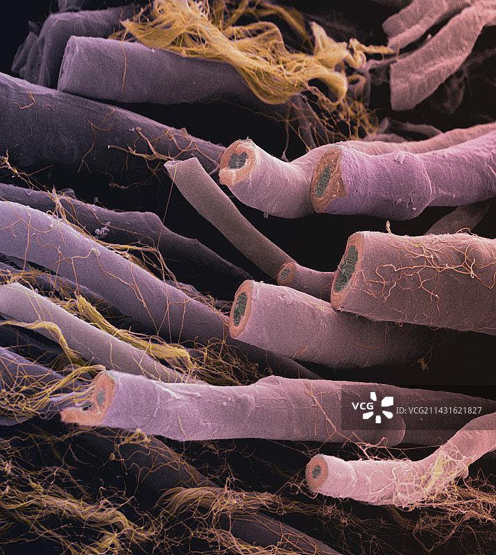 神经纤维扫描电镜照片图片素材