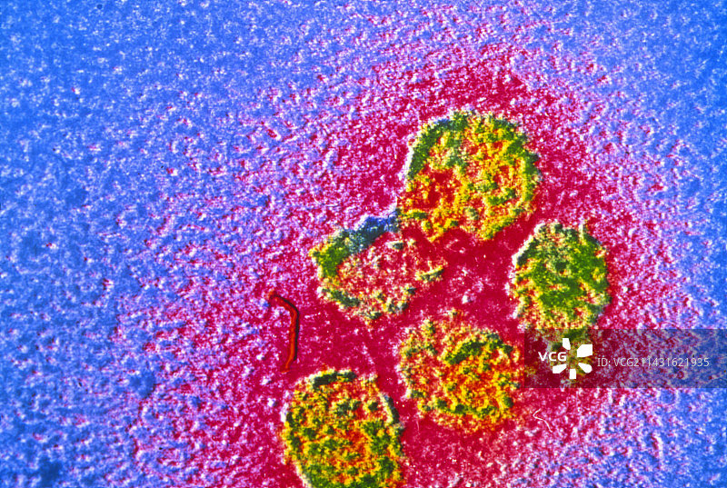 黄热病病毒的病毒粒子透射电镜图像图片素材