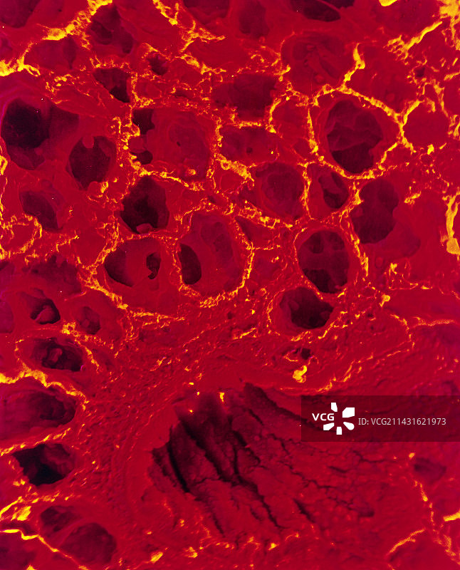 人肺组织切片的扫描电镜图图片素材