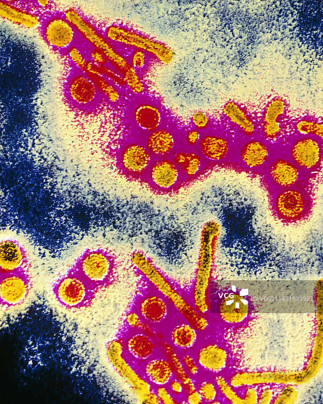 乙型肝炎病毒颗粒的伪彩TEM图片素材